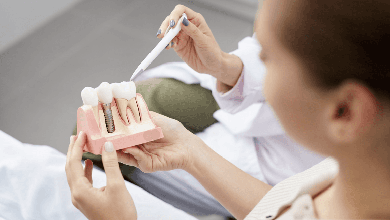 dental implants illustration in Mesquite, TX